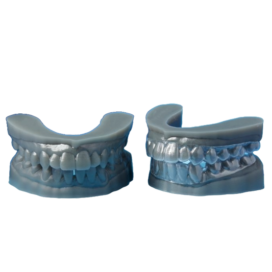 Full-Service Refinement Aligners