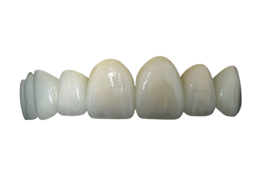 Multilayered Zirconia Crown(s)